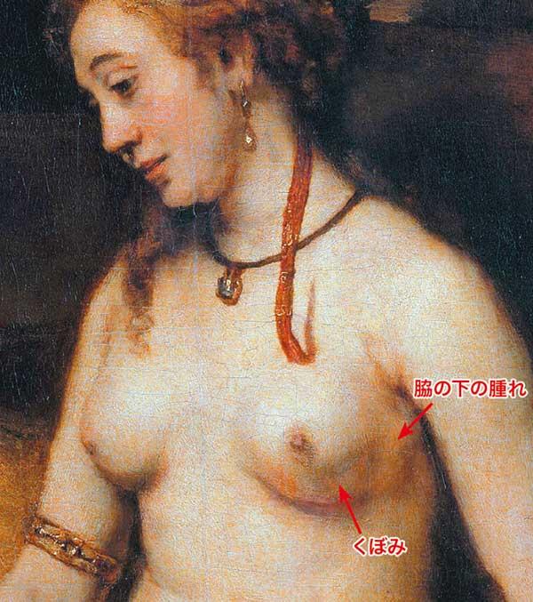 モデルの乳がんを レンブラントは意図せず描いた 名画の謎を解く ニューズウィーク日本版 オフィシャルサイト モデルの乳がんを レンブラントは意図せず描いた 名画の謎を解く ニューズウィーク日本版 オフィシャルサイト
