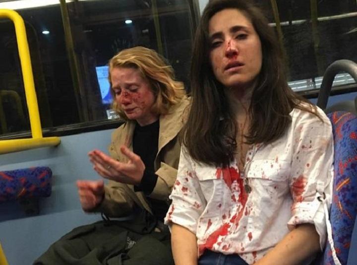 英レズビアンカップル暴行事件 被害者2人の危機感 ワールド 最新記事 ニューズウィーク日本版 オフィシャルサイト 英レズビアンカップル暴行事件 被害者2人の危機感 ワールド 最新記事 ニューズウィーク日本版 オフィシャルサイト