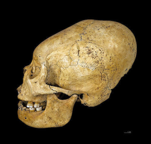 人為的に変形された1万00年前の頭蓋骨が中国で発掘される ニューズウィーク日本版 オフィシャルサイト 人為的に変形された1万00年前の頭蓋骨が中国で発掘される ニューズウィーク日本版 オフィシャルサイト