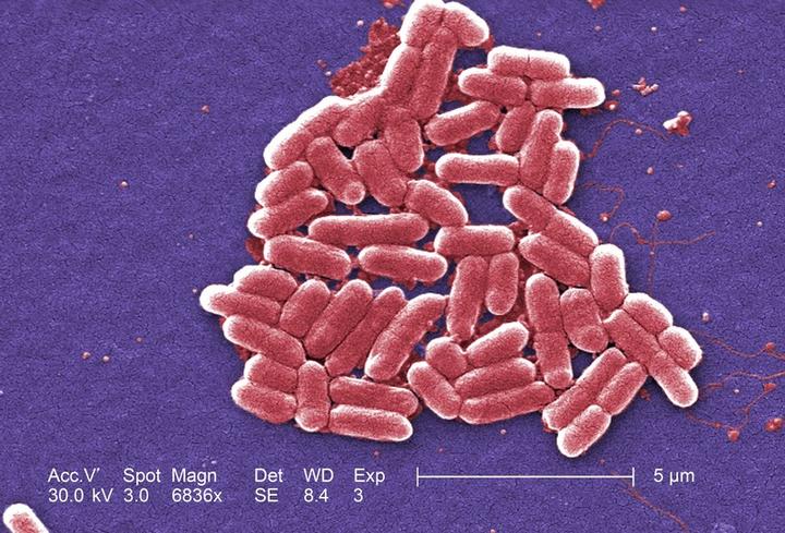 あらゆる抗生物質が効かない スーパー耐性菌 アメリカで初の感染が見つかる ワールド 最新記事 ニューズウィーク日本版 オフィシャルサイト