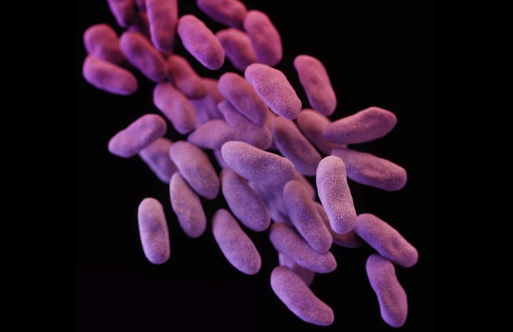スーパー耐性菌の脅威 米国で使える抗生物質がすべて効かない細菌で70代女性が死亡 ワールド 最新記事 ニューズウィーク日本版 オフィシャルサイト