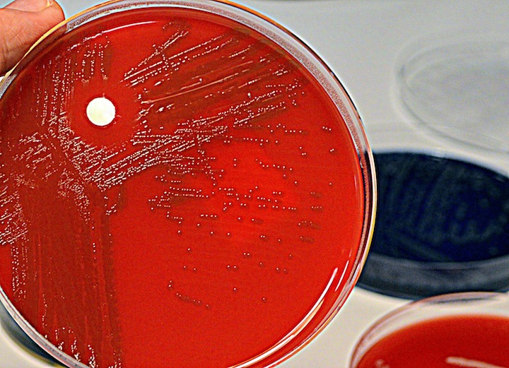 どの抗生物質も効かない スーパーバグ が世界に蔓延 豪科学者が警告 ニューズウィーク日本版 オフィシャルサイト どの抗生物質も効かない スーパーバグ が世界に蔓延 豪科学者が警告 ニューズウィーク日本版 オフィシャルサイト