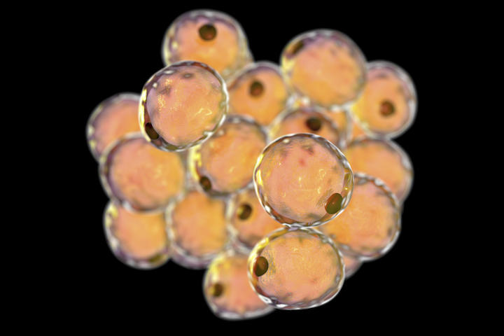 乳がん細胞を脂肪細胞に変えることに成功 バーゼル大学の研究 ニューズウィーク日本版 オフィシャルサイト