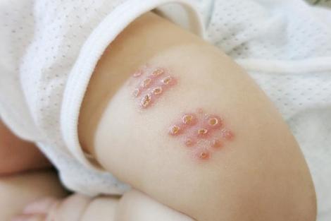 gワクチンの効果を検証する動きが広がる 新型コロナウイルス拡大防止に ワールド 最新記事 ニューズウィーク日本版 オフィシャルサイト gワクチンの効果を検証する動きが広がる 新型コロナウイルス拡大防止に ワールド 最新記事 ニューズウィーク日本版 オフィシャルサイト