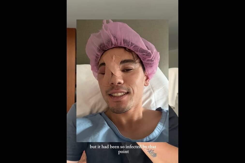 小さなニキビだと油断していたら目をふさぐほど巨大に膨れ上がった